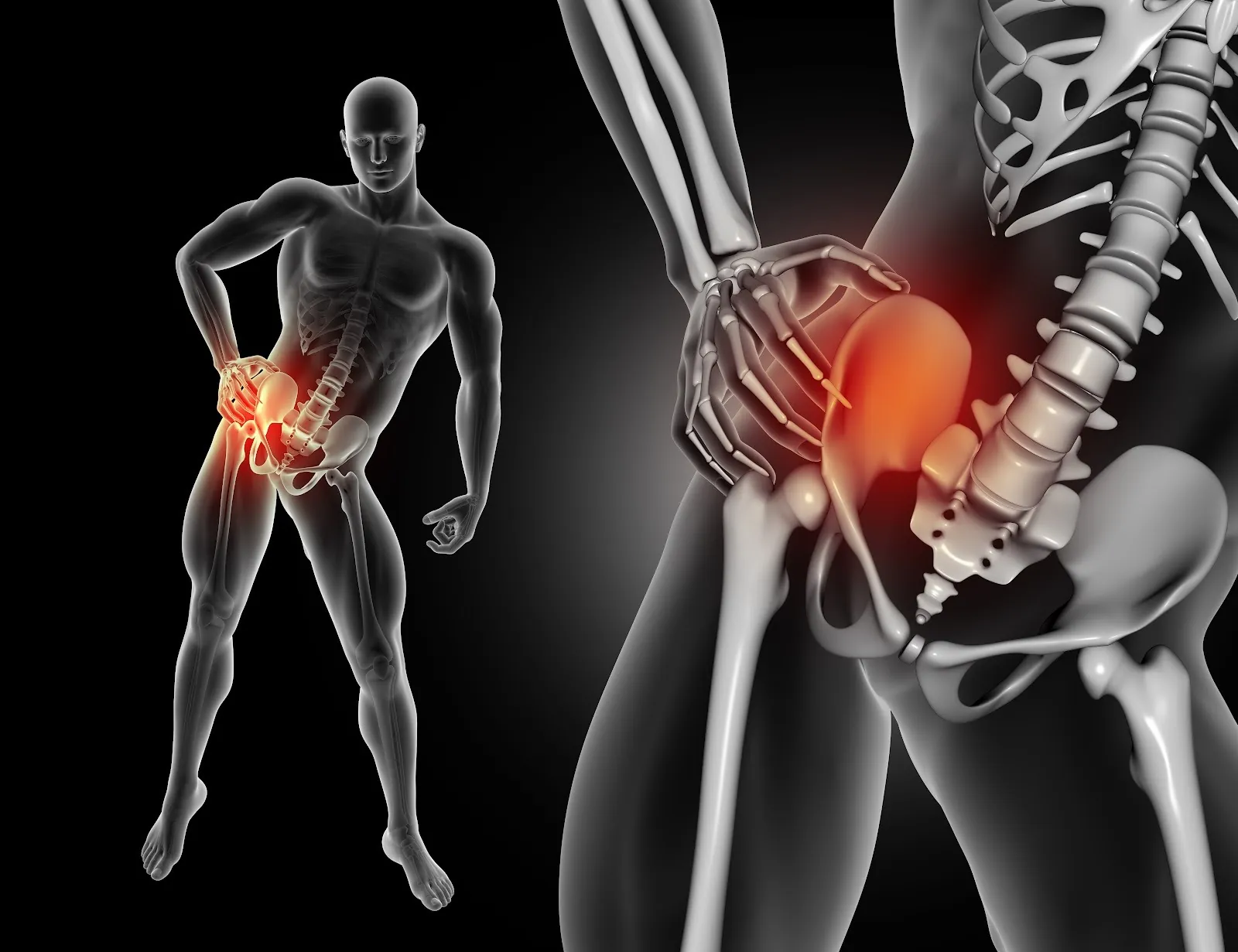 3D illustration of hip and lower spine pain areas