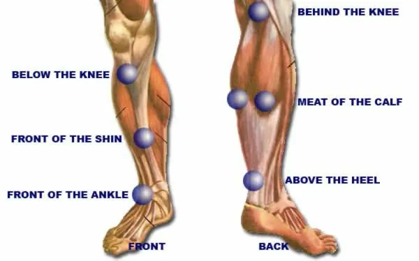 Diagram of common pain locations in the front and back of the leg