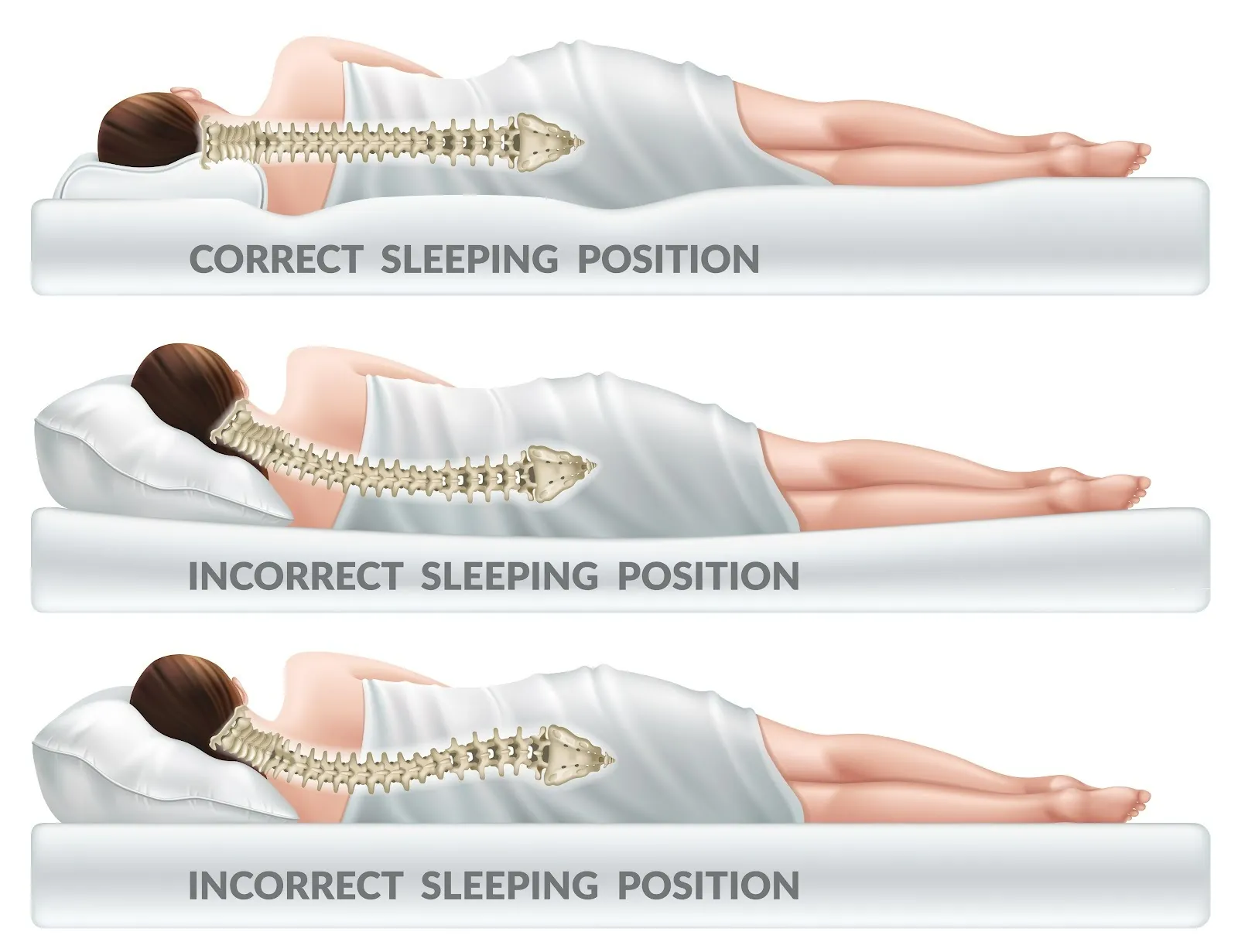 Diagram of correct and incorrect sleeping positions and spine alignment
